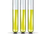 Cortisol-Awakening-Response-CAR-Test-Kit