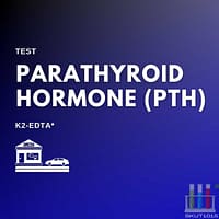 K2-EDTA parathyroid hormone test