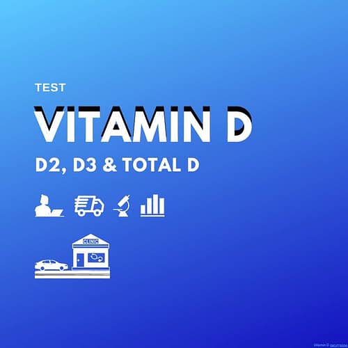 category-all-other-tests-vitamin-d-test