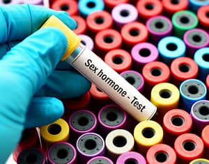 sex hormone testing vial blog imagery