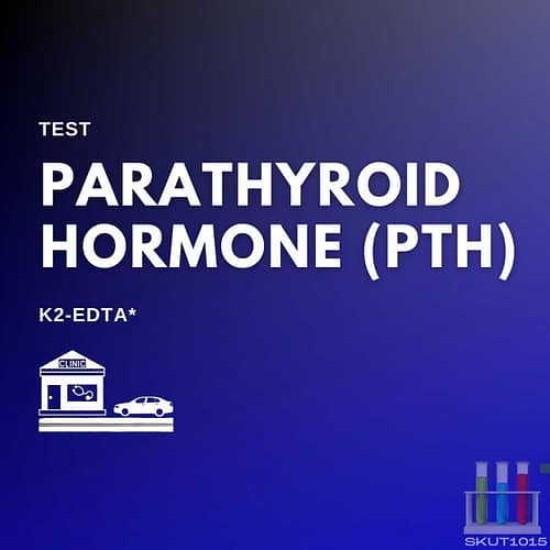 K2-EDTA parathyroid hormone test