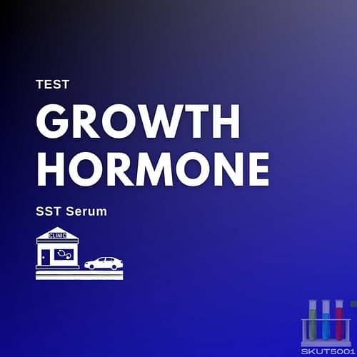 sst serum hgh test