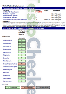 Macrons test redacted test results for viewing